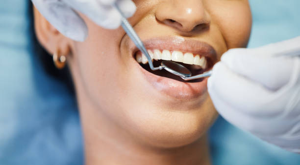 Best Emergency Dental Care for Abscessed Tooth in Odon, IN